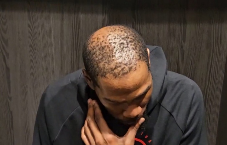 国际足联官方中文网站-37岁还单身有原因😳！杜兰特秃顶这么严重 这发量找对象难啊